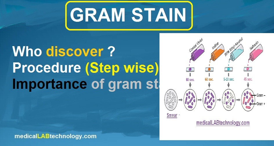 Gram Staining Procedure, Principle, Technique, Uses