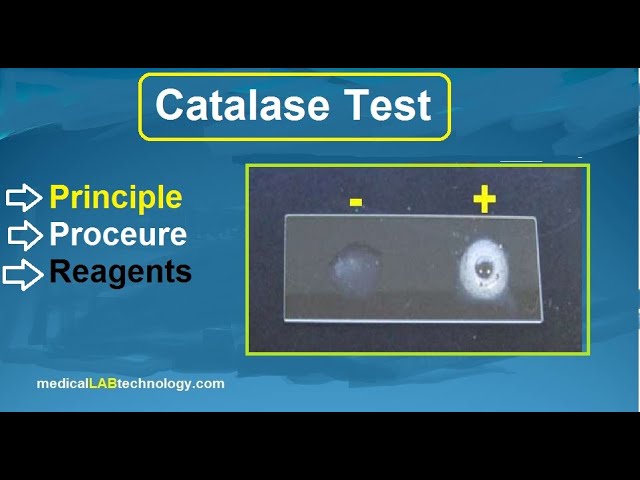 catalase test principle procedure reagent microbiology