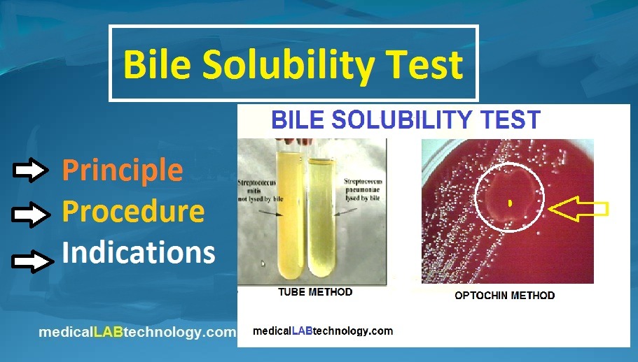 bile solubility test,principle, procedure