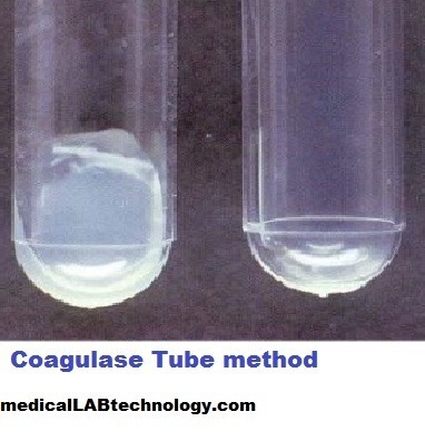 coagulase test principle procedure