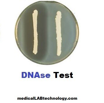 Deoxyribonuclease test (DNAse): Principle, procedure