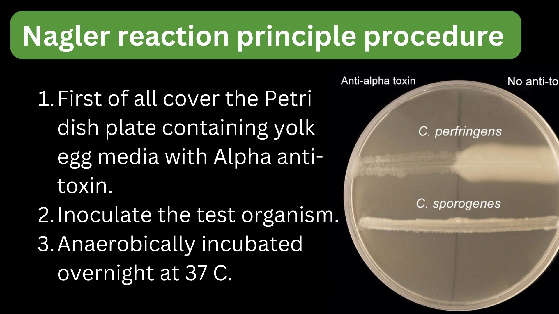 Clostridium perfringens Nagler reaction principle procedure (lecithinase test)