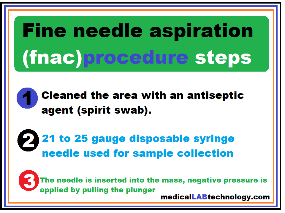 Fine needle aspiration procedure steps cytology (fnac), complications