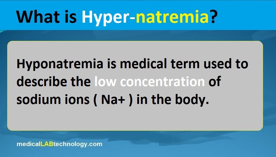 Hypernatremia and hyponatremia causes