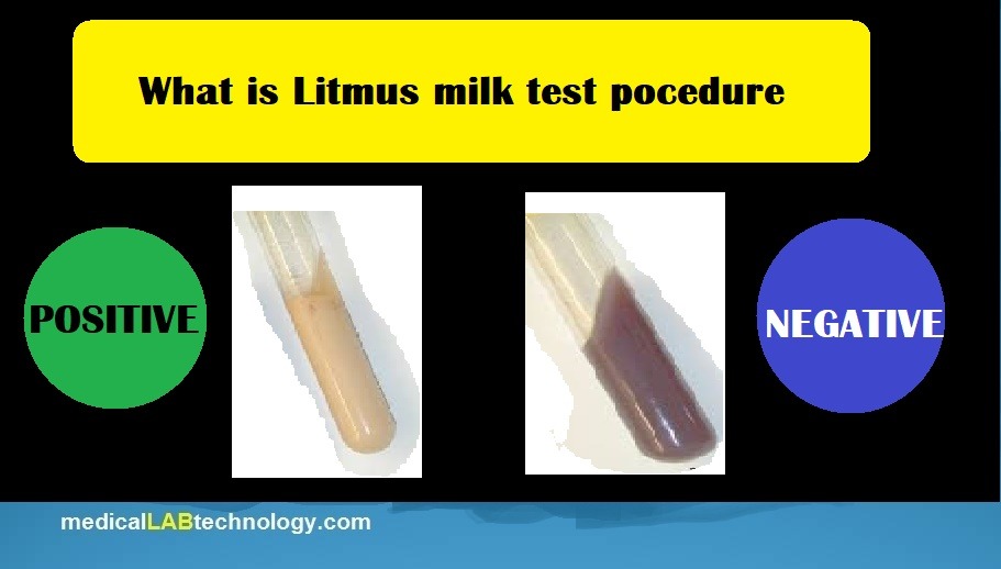 Litmus milk test procedure, result, purpose in microbiology