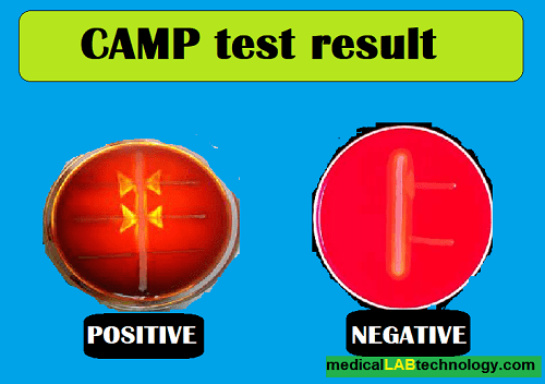 CAMP test result, CAMP factor test, Group B strep test,  
