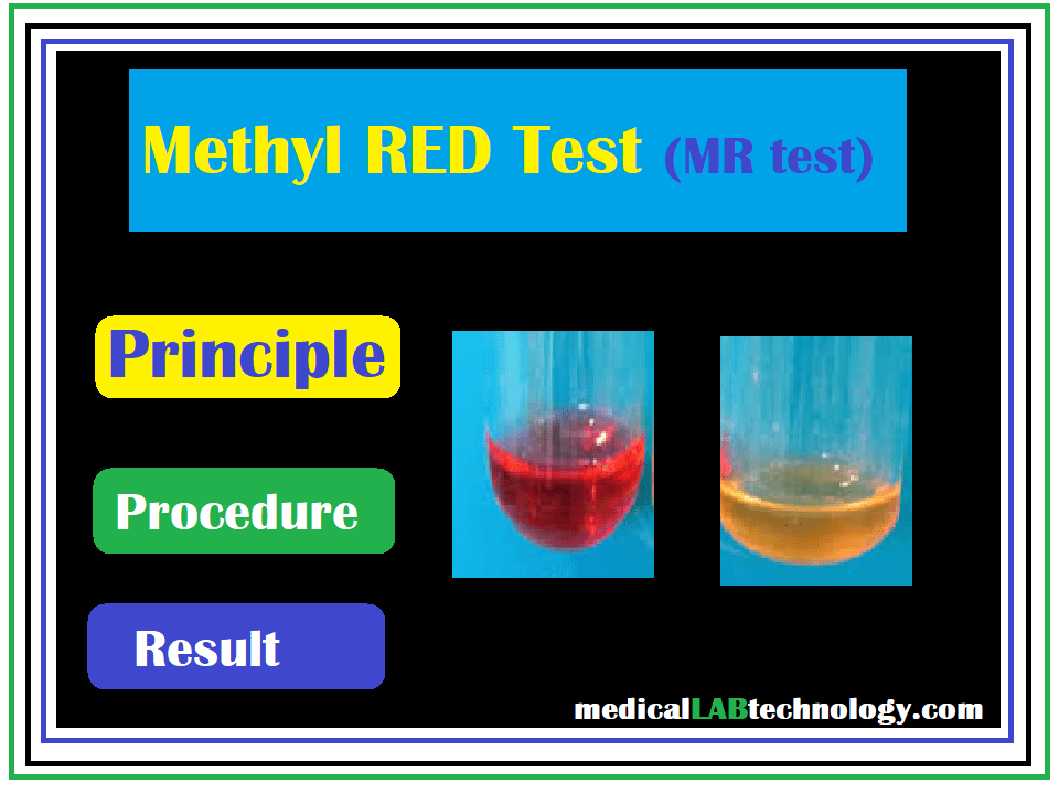 Methyl red test principle, procedure, reagents (e.coli)