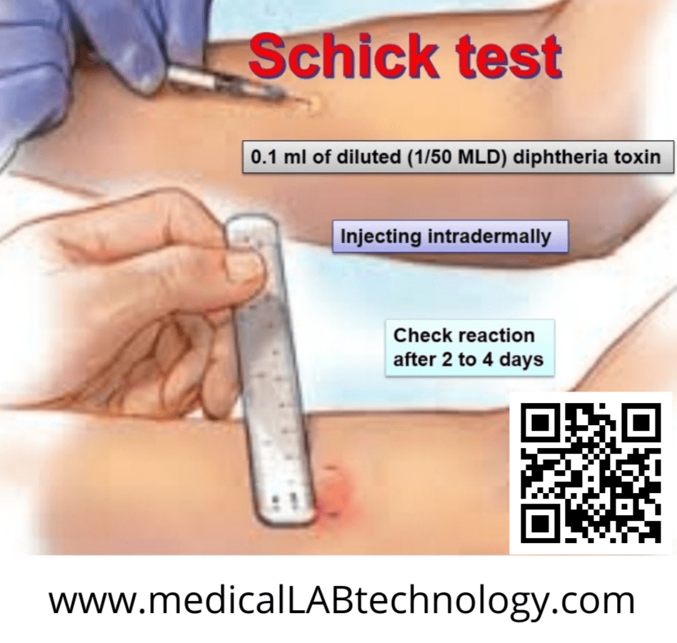 Schick test principle procedure, interpretation (Dephtheria test)