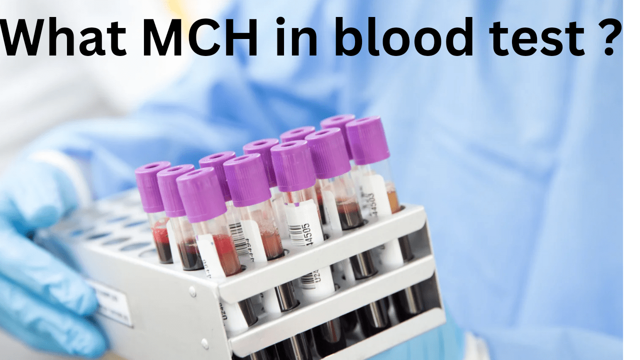 what is MCH in blood test