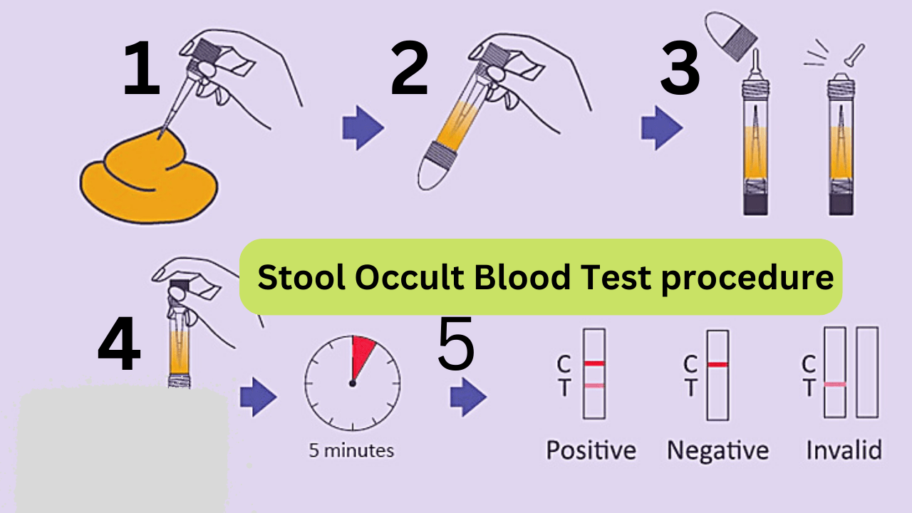 Stool occult blood test procedure step by step in lab