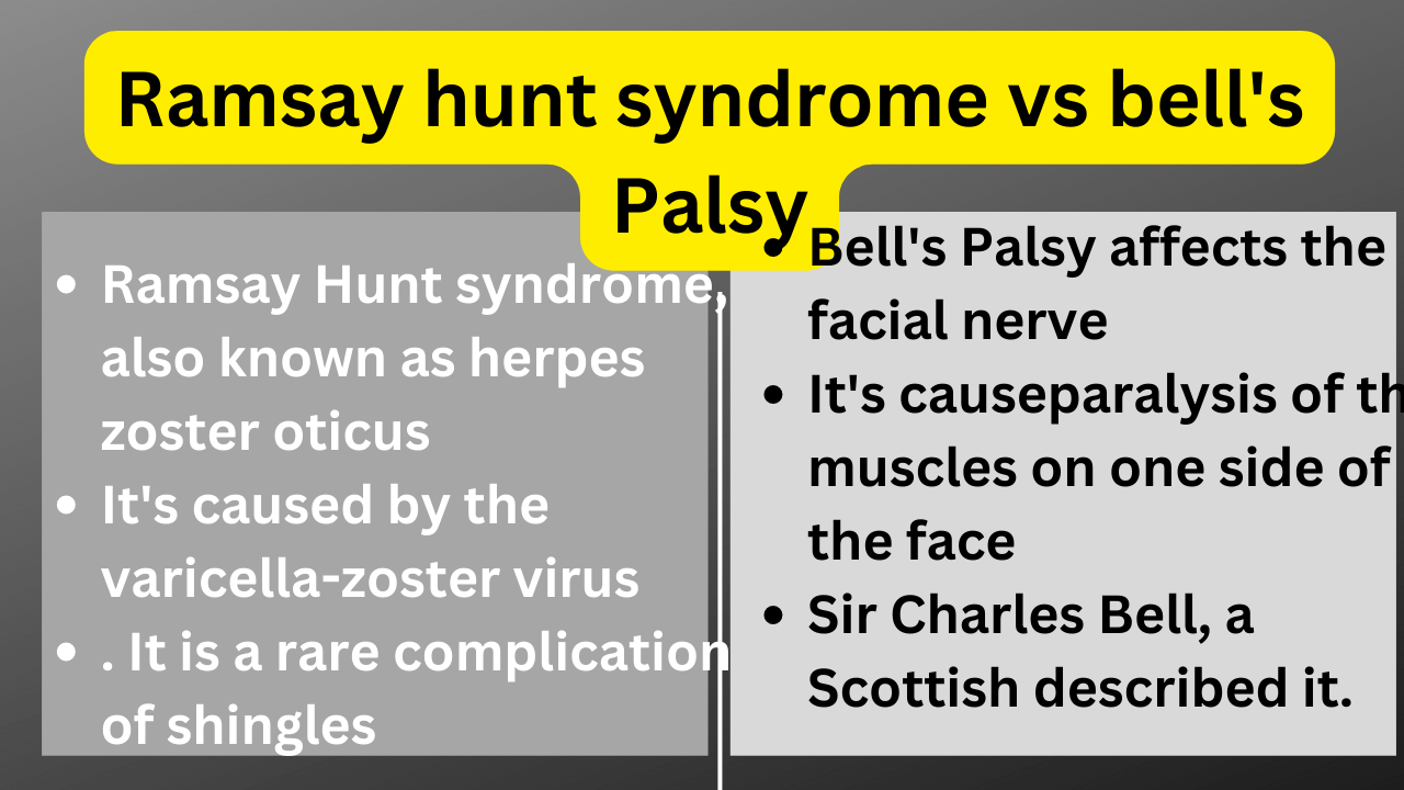 Ramsay hunt syndrome vs bell's palsy