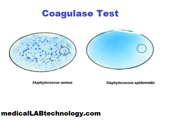 Coagulase Test Principle Procedure (Slide /Tube Method)