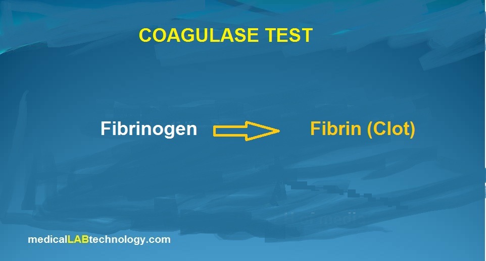 Coagulase Test Principle, Procedure