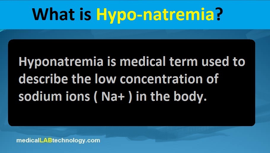 Hypernatremia and hyponatremia causes