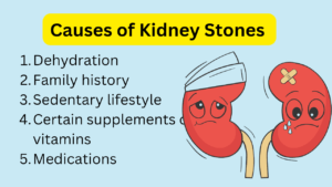 How to stop kidney stone pain immediately,  what are the causes of Kidney Stones, 