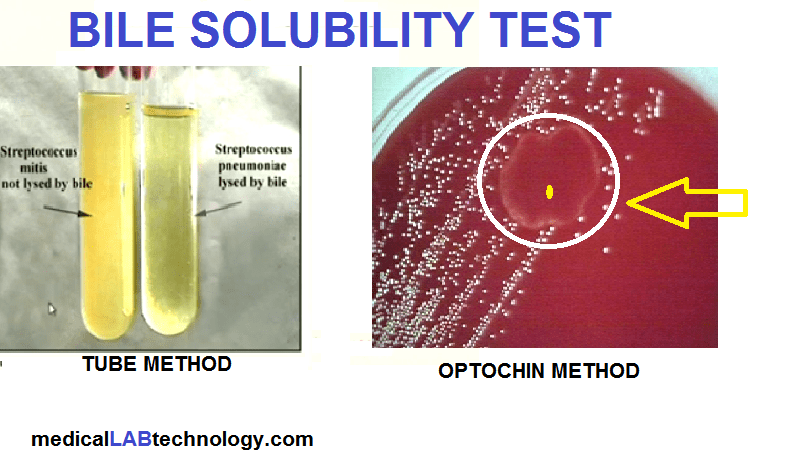 Bile Solubility Test Principle, Procedure, Result