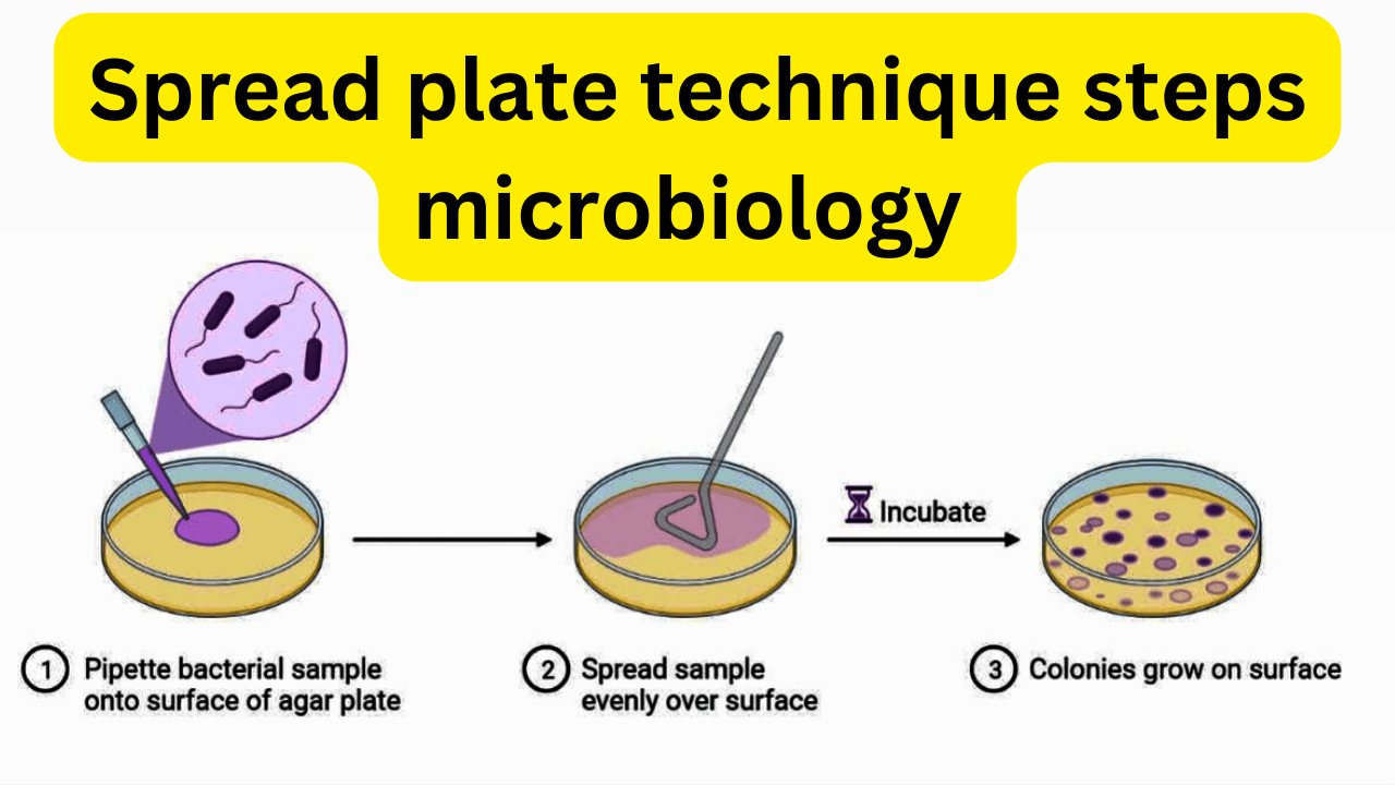 Spread plate technique procedure steps in microbiology