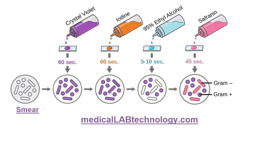 Gram staining procedure, principle, technique, uses