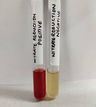 Nitrate reduction test principle, procedure, purpose, result