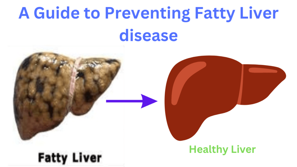 From Bad Fats to Healthy Liver: A Guide to Preventing Fatty Liver disease