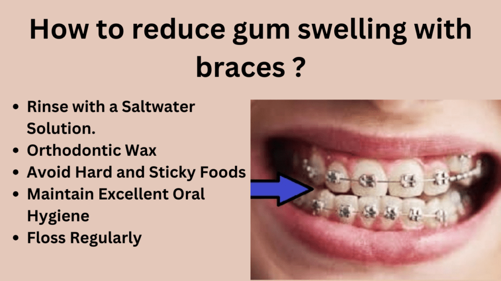 How to reduce gum swelling with braces