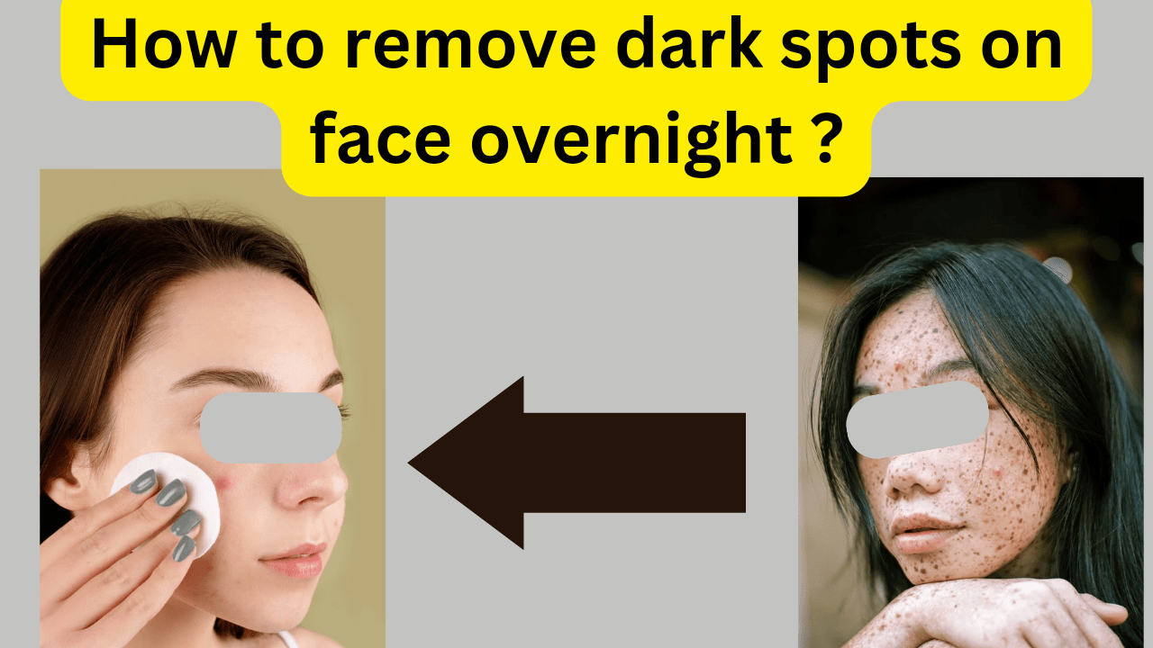 how to remove dark spots on face overnight