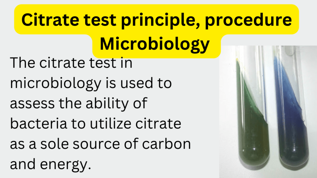 Citrate test principle, procedure, result, purpose