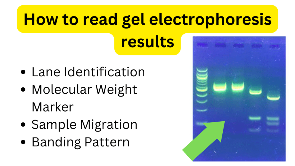 How to read gel electrophoresis results