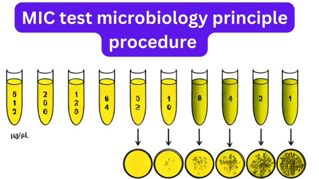 MIC test microbiology principle, procedure