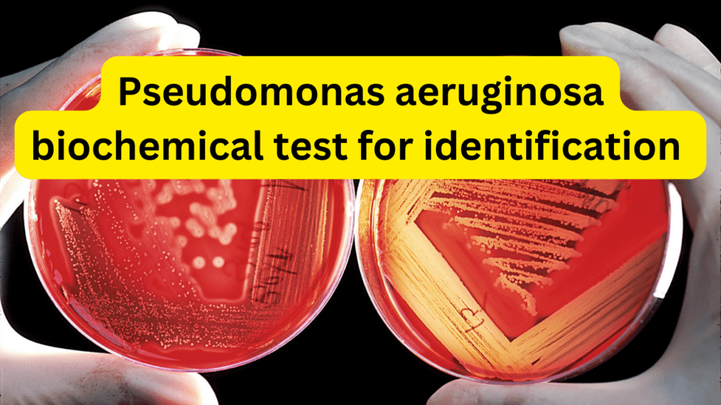 Pseudomonas aeruginosa biochemical test