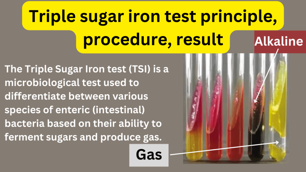 Triple sugar iron test principle, procedure, result