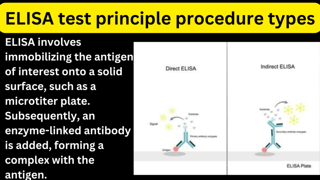 ELISA test principle procedure types