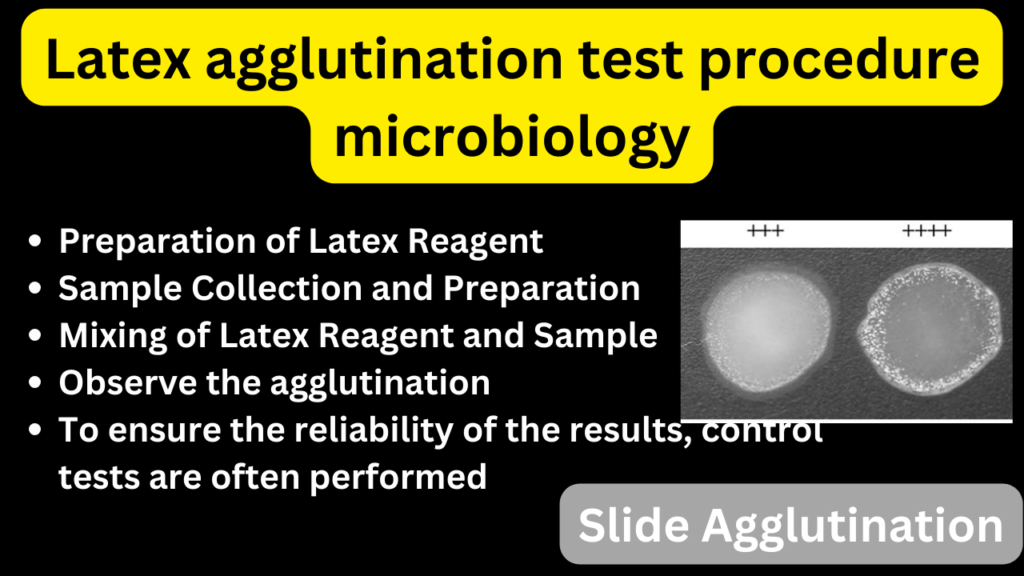 Latex agglutination test principle procedure microbiology