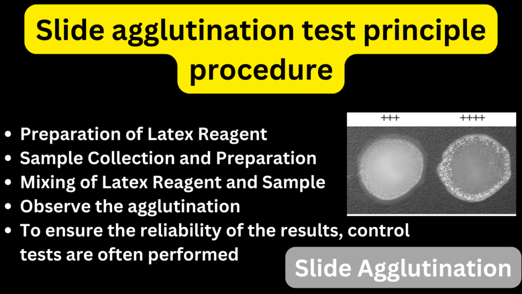 Slide agglutination test principle procedure