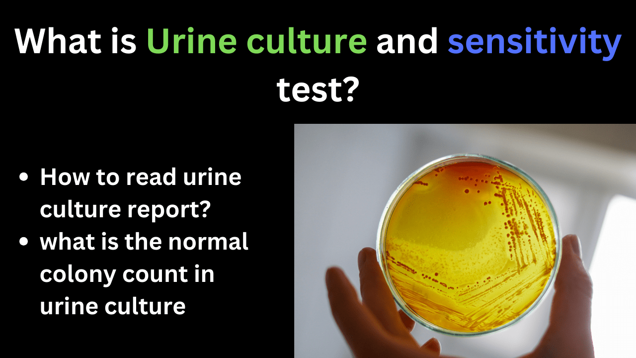 What is Urine culture and sensitivity test How to read it