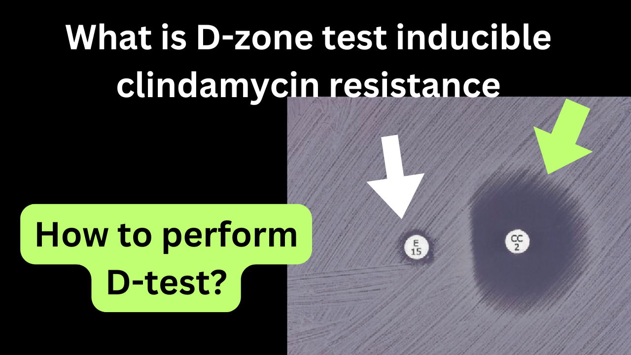 What is d zone test inducible clindamycin resistance test in microbiology