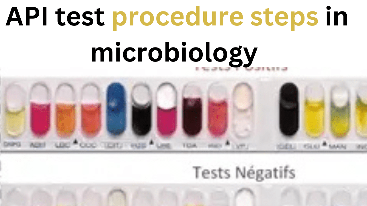 Api test procedure microbiology