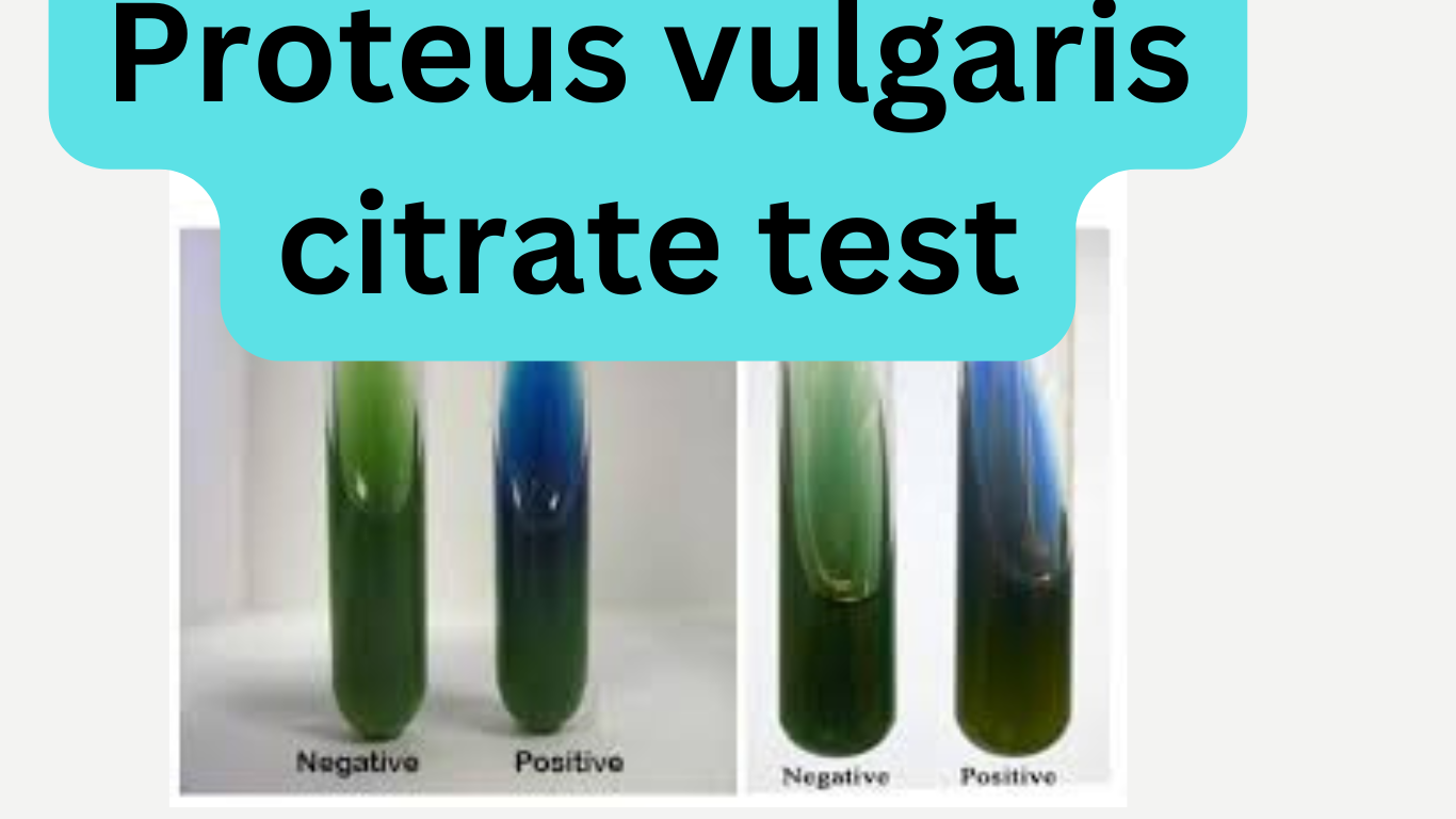 Proteus vulgaris citrate test