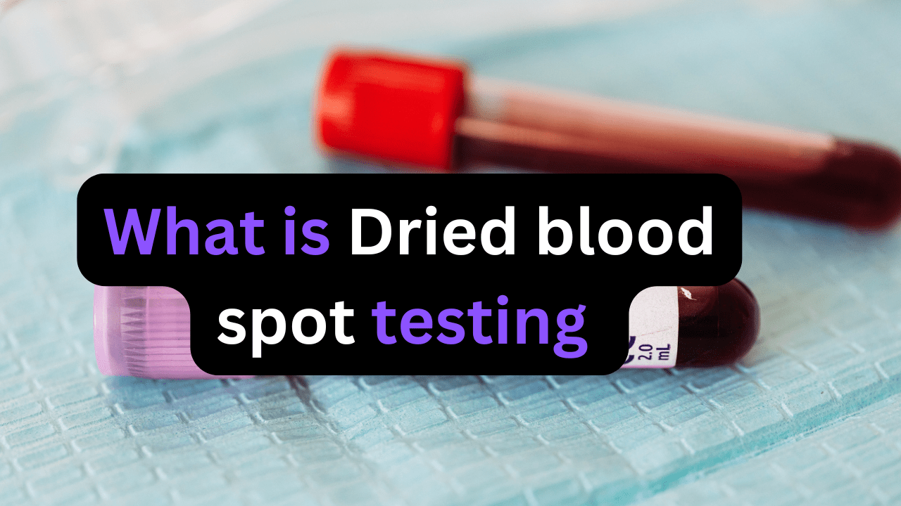 dried blood spot testing procedure