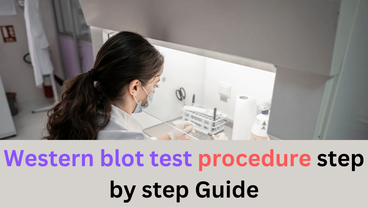 Western blot test procedure step by step Guide