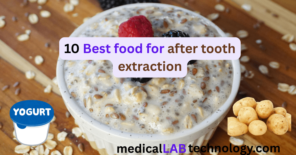 list of food for after tooth extraction