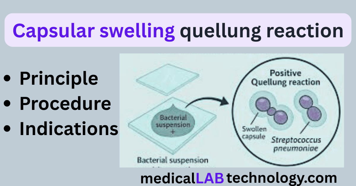 Quellung Reaction for Streptococcus pneumoniae Principle, Procedure, and Result